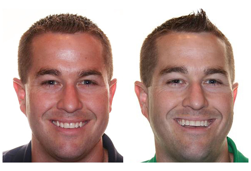 Rahway Family Dental   Orthodontics