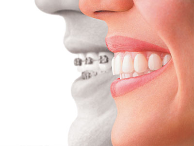 Rahway Family Dental   Orthodontics | Full Mouth Reconstruction, Oral Exams and Night Guards