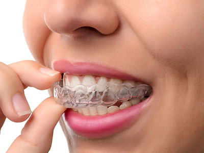 Rahway Family Dental   Orthodontics | Digital Impressions, Cosmetic Dentistry and TMJ Disorders